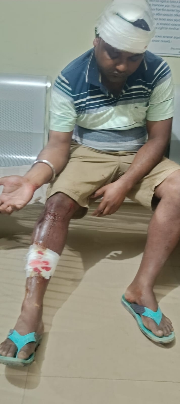 ହତ୍ୟା ଉଦ୍ୟମ ବିଫଳ, ଯୁବକଙ୍କୁ ନିସ୍ତୁକ ମାଡ଼ ପରେ  ଡାକ୍ତରଖାନାରେ ଭର୍ତ୍ତି