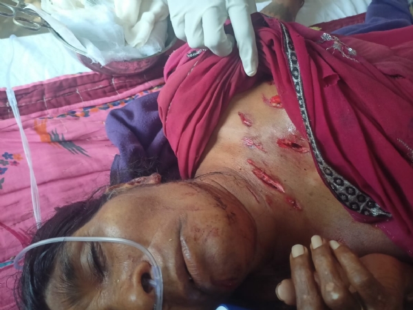 Bear attack one death