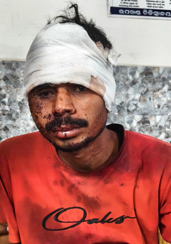 ସରକାରୀ ବସ କର୍ମଚାରୀଙ୍କ ମରଣାତ୍ମକ ଆକ୍ରମଣ : ଗୁରୁତର ଅବସ୍ଥାରେ ଯୁବକ ଚିକତ୍ସାଧୀନ