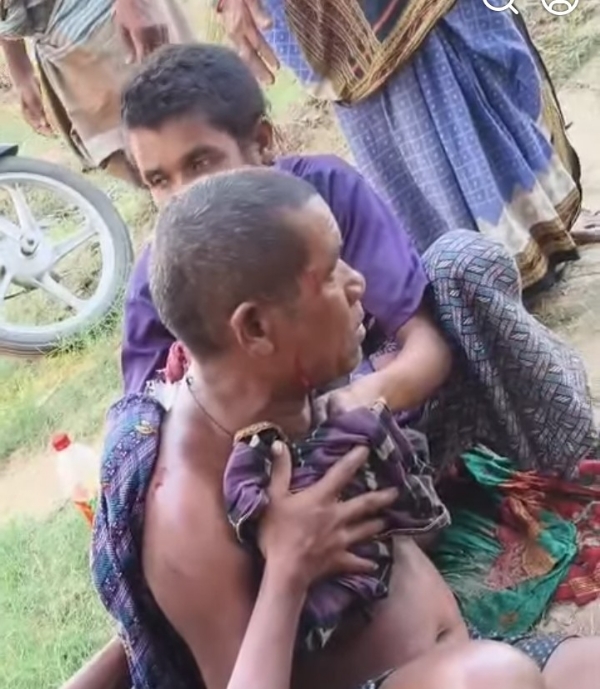 ନଦୀ କୂଳରୁ ବୃଦ୍ଧଙ୍କୁ ପଛପଟୁ ଝାମ୍ପିଲା କୁମ୍ଭୀର : ମରଣ ମୁହଁରୁ ଅଳ୍ପକେ ବର୍ତିଲେ : ମେଡିକାଲରେ ଭର୍ତି