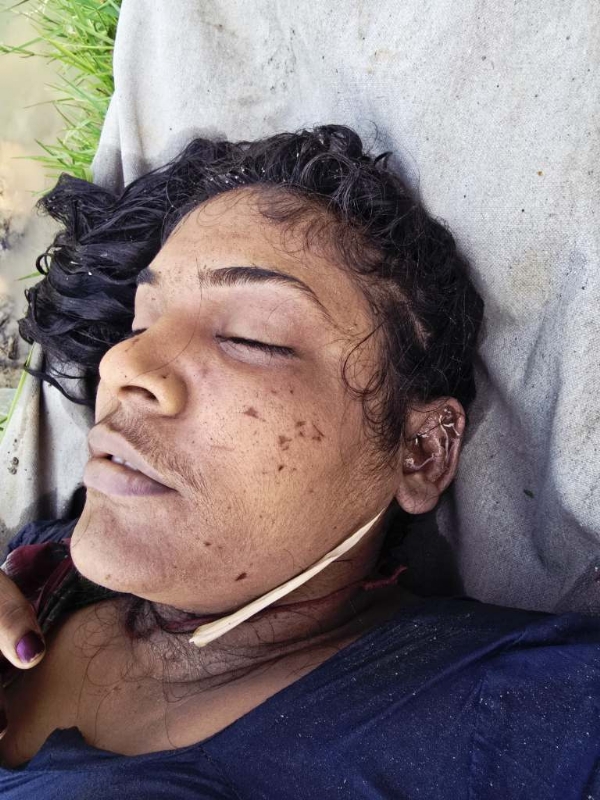 NAI KULARU MAHILA MRUTADEHA UDHAR NAI KULARU MAHILA MRUTADEHA UDHAR