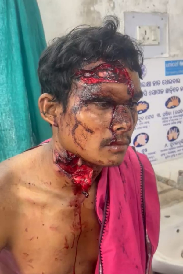 ଭାଲୁ ଆକ୍ରମଣରେ ୨ଜଣ ଗୁରୁତର