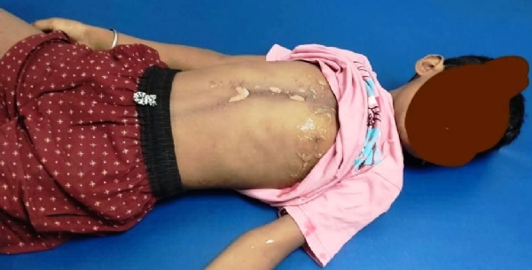 BAJRAPATARE 8 YEARS CHILD DEATH