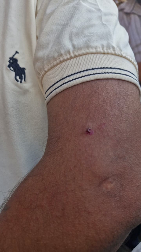 हादसे में घायल दुकानदार